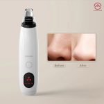 میکرودرم Enchen EB1001